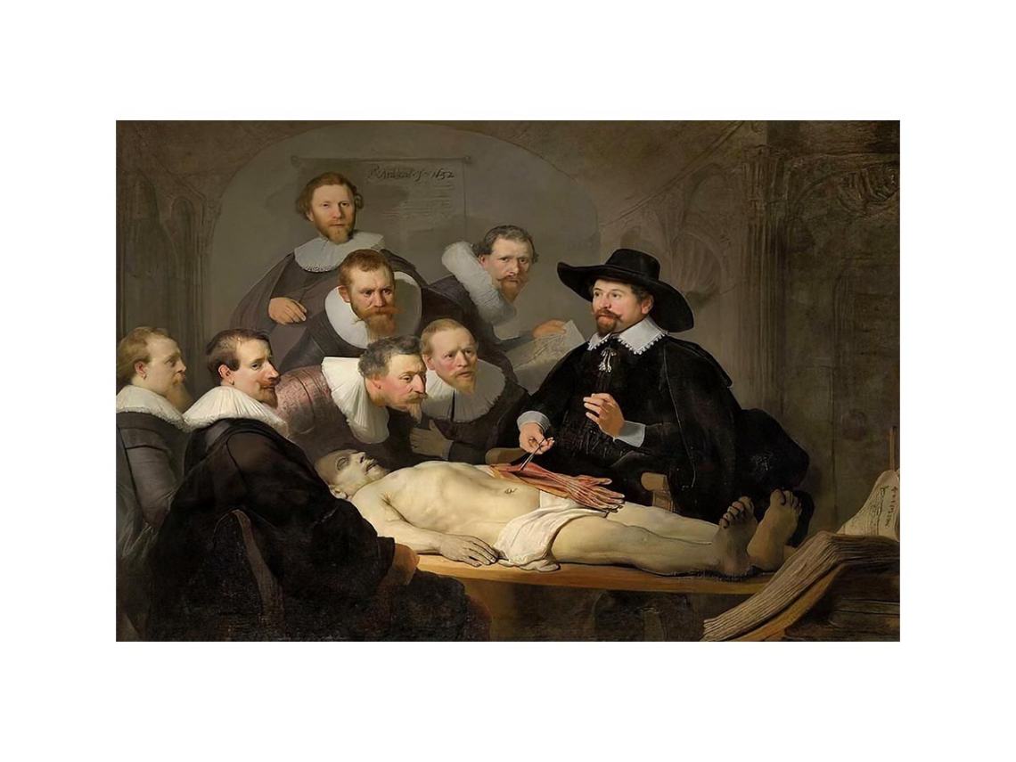 Anatomy Lesson of Dr Tulp by Rembrandt Van Rijn